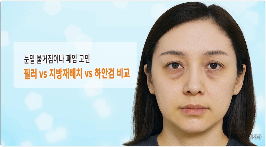 눈밑 패임 필러와 지방재배치, 하안검 비교