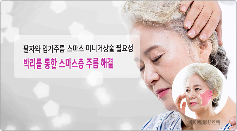 스마스 미니 거상술 필요성