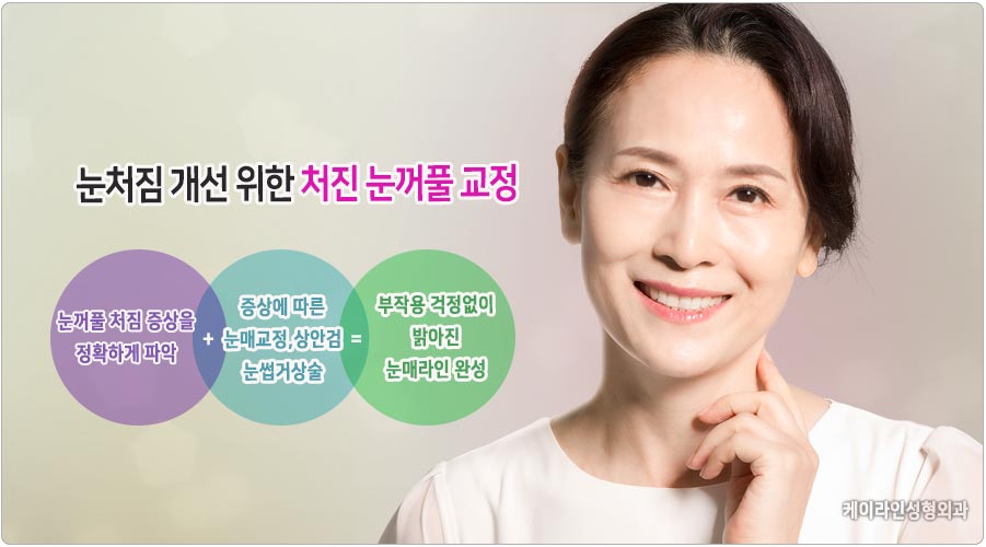 중년 눈수술