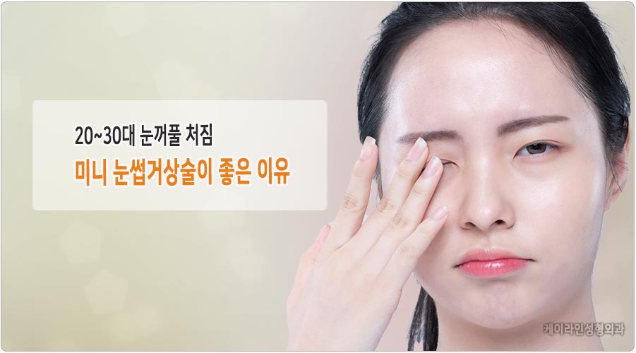 20대 눈꺼풀 처짐 미니 눈썹거상술