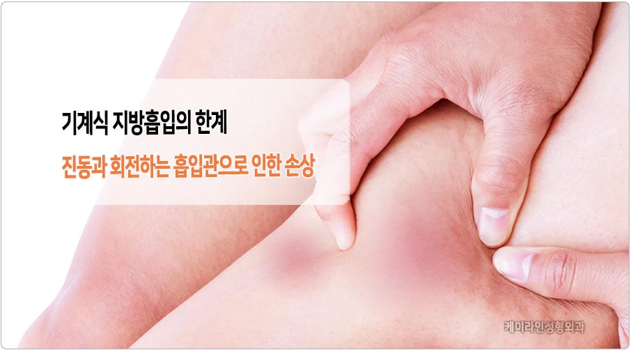 기계식 지방흡입 부작용