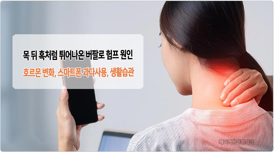 버팔로 험프 원인