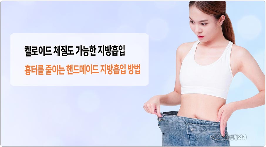 켈로이드 체질 지방흡입