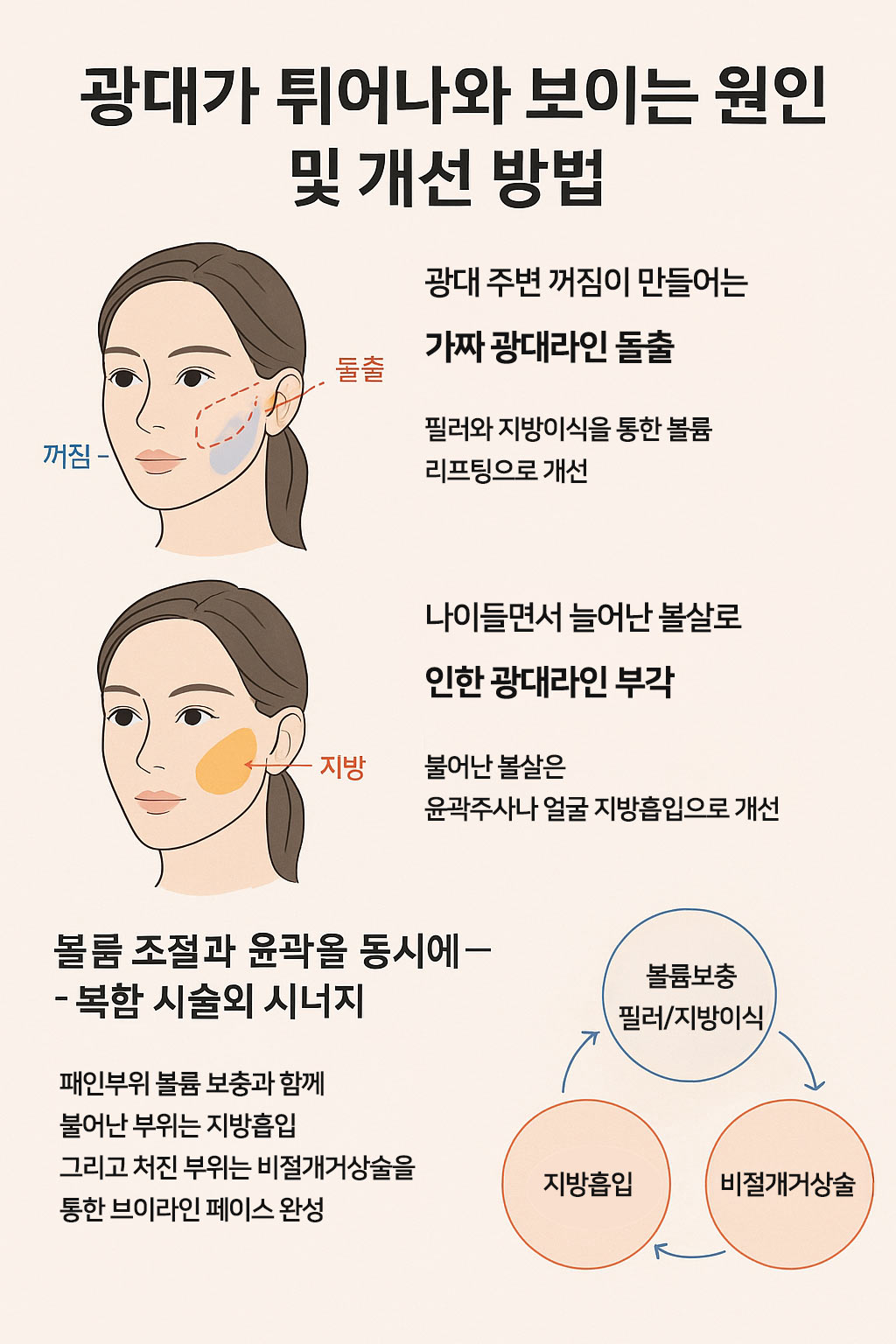 광대 축소 시술