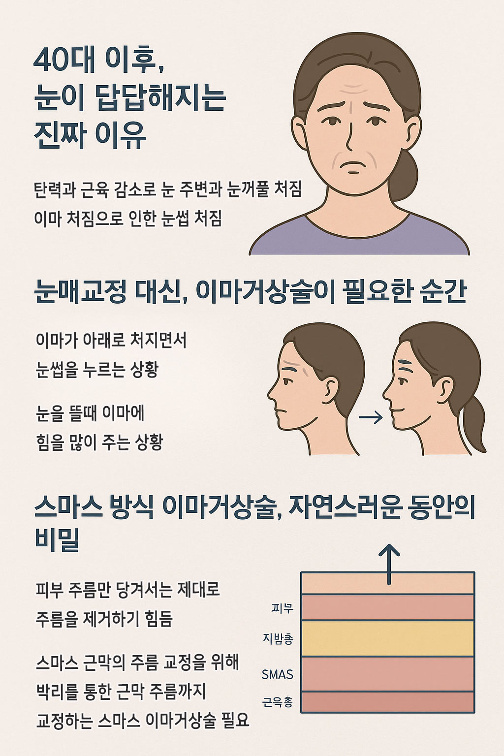 눈처짐 교정