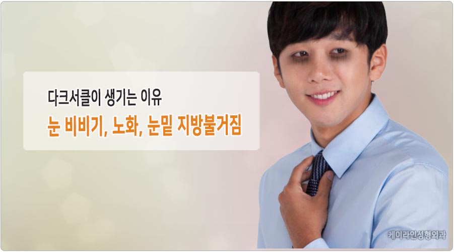 다크서클 원인