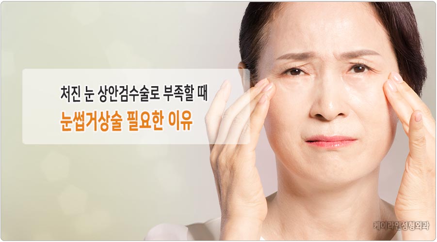 처진눈 상안검 부족한 이유