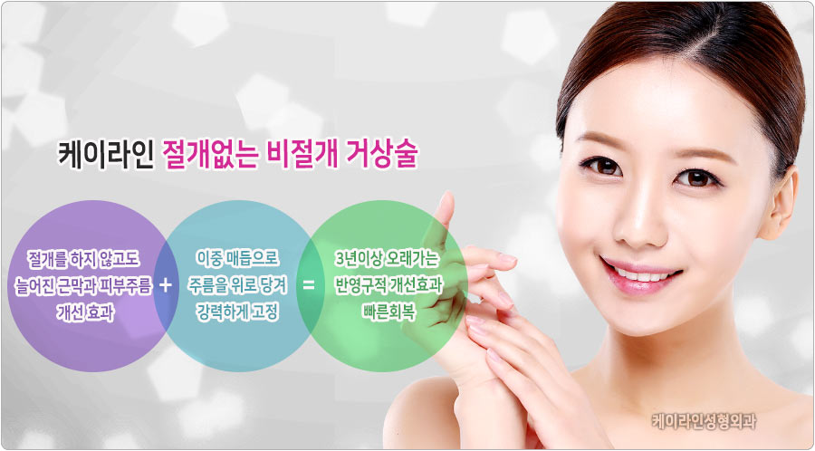 비절개거상술