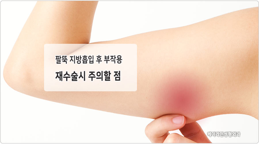 팔 지방흡입 후 부작용 재수술 가능할까요? 지흡 재수술 : 케이라인 자주묻는질문