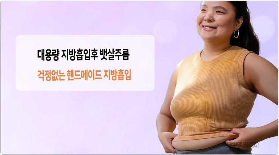 대용량 지방흡입 후 뱃살 주름
