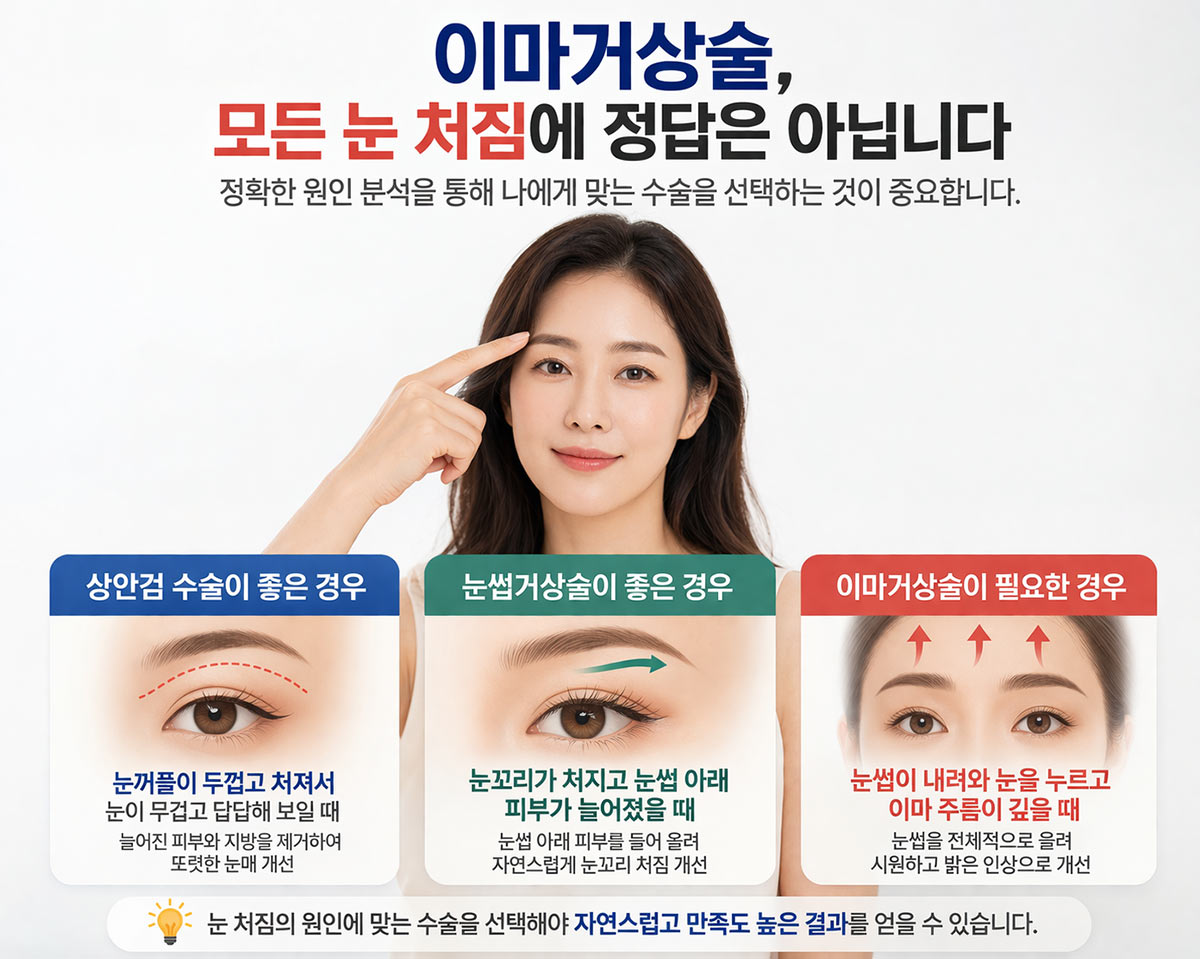 이마거상술과 눈썹거상술 차이점