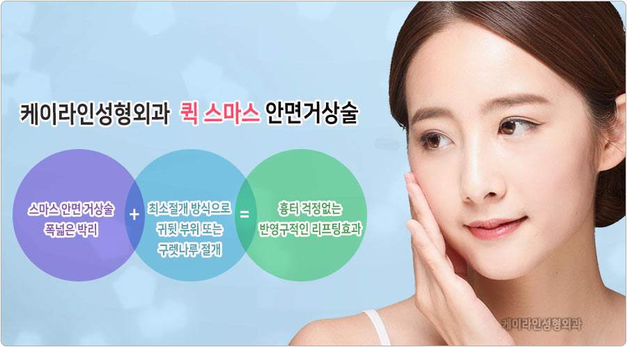 퀵 스마스 안면거상술 장점