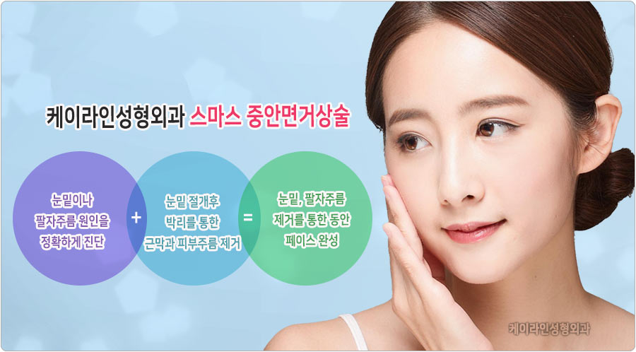 중안면거상술 장점