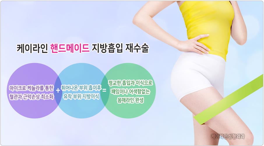 지방흡입 재수술