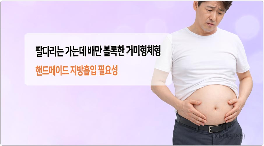 거미형 체형 지방흡입 필요성