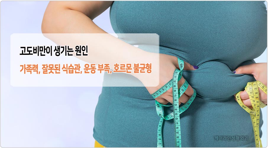 고도비만 원인