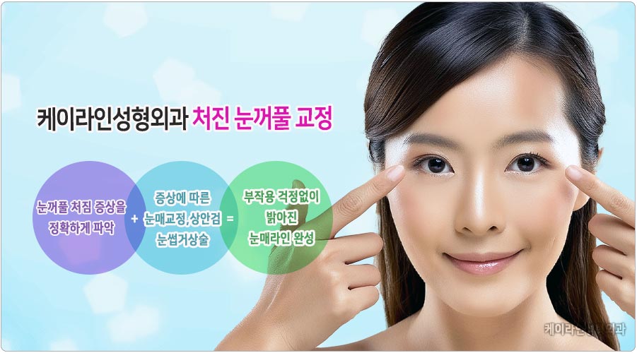 처진 눈 교정 방법