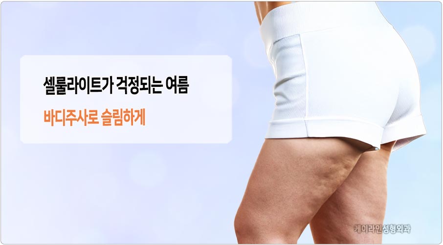 셀룰라이트가 걱정되는 여름 바디주사 필요성