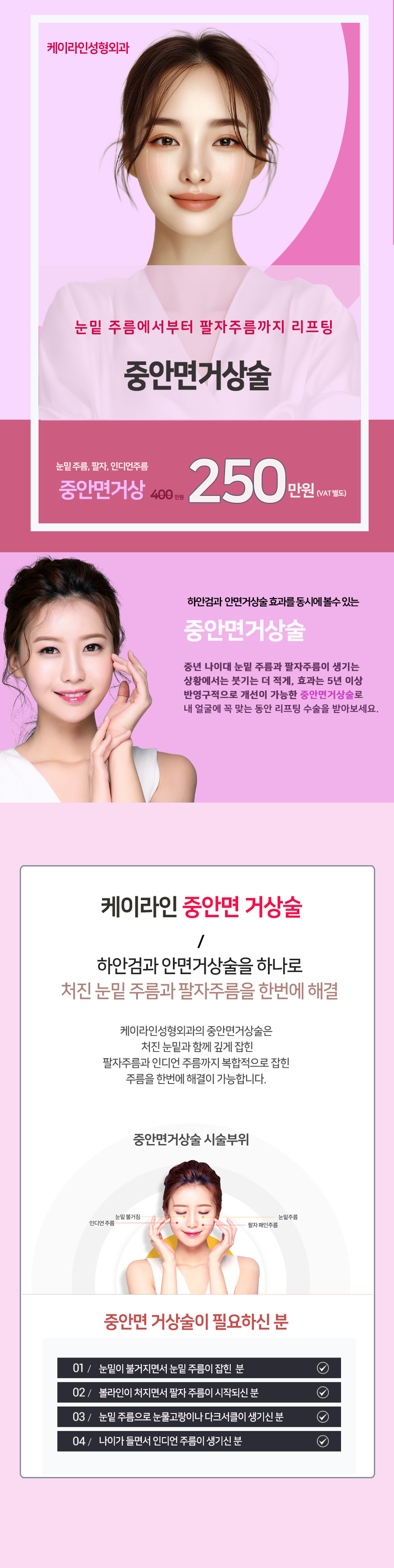 중안면거상술 장점