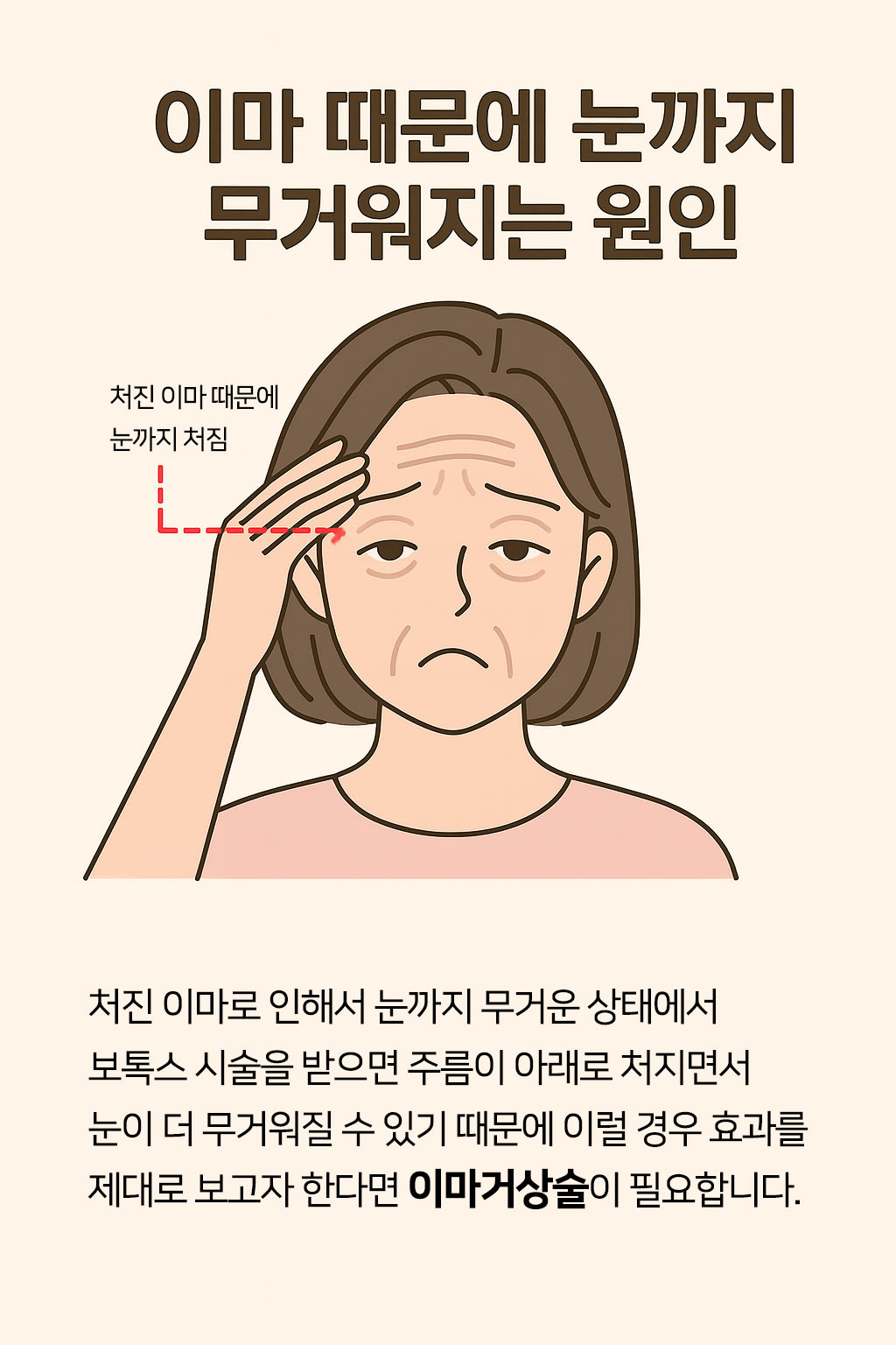 눈이 처지는 원인
