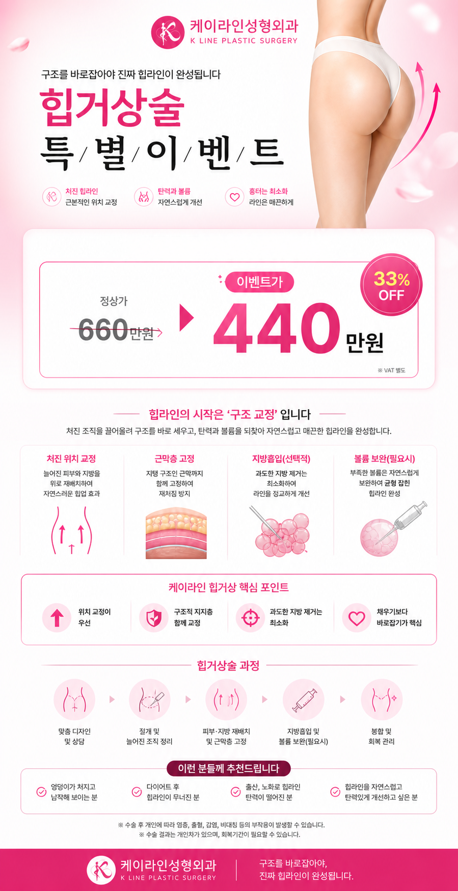 힙거상술 이벤트