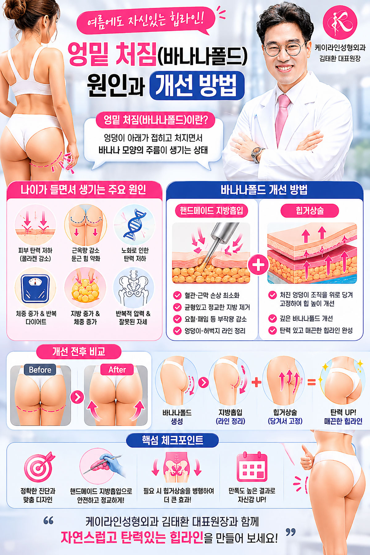 바나나폴드 개선 방법