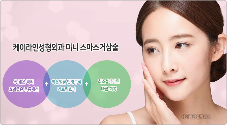 스미스 미니 거상술 장점