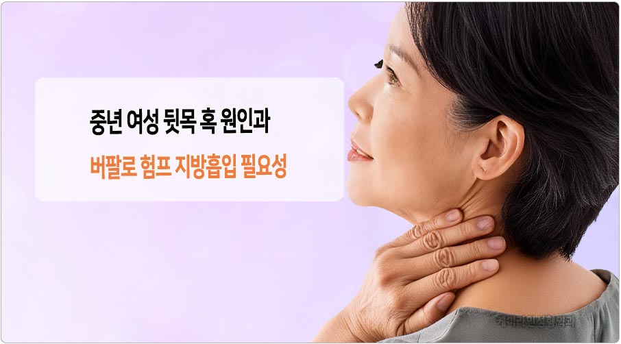 뒷목 혹 원인과 버팔로 험프 지방흡입 필요성