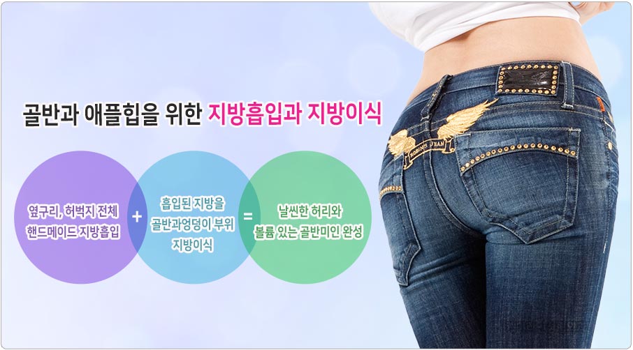 골반라인 지방흡입과 지방이식 방법