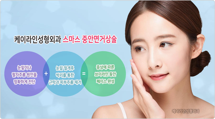 중안면거상술
