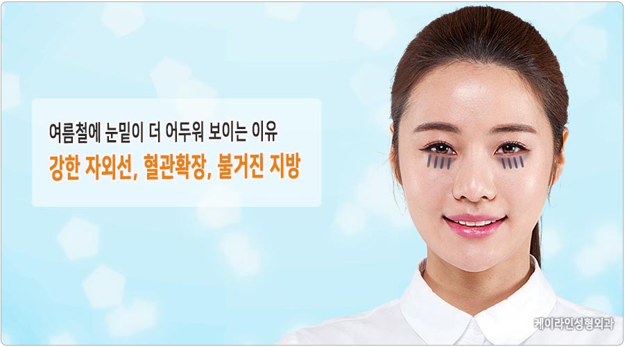 다크서클 원인