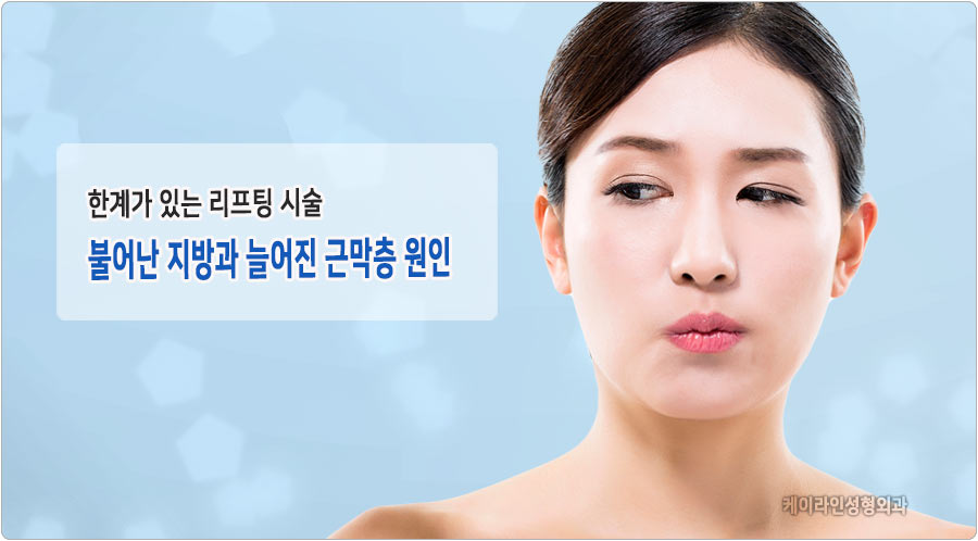 리프팅 시술 한계