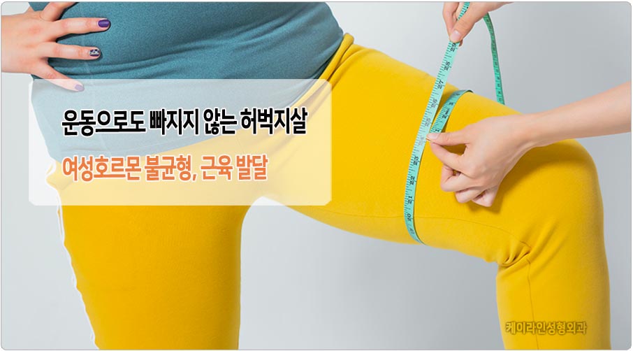 허벅지살 원인