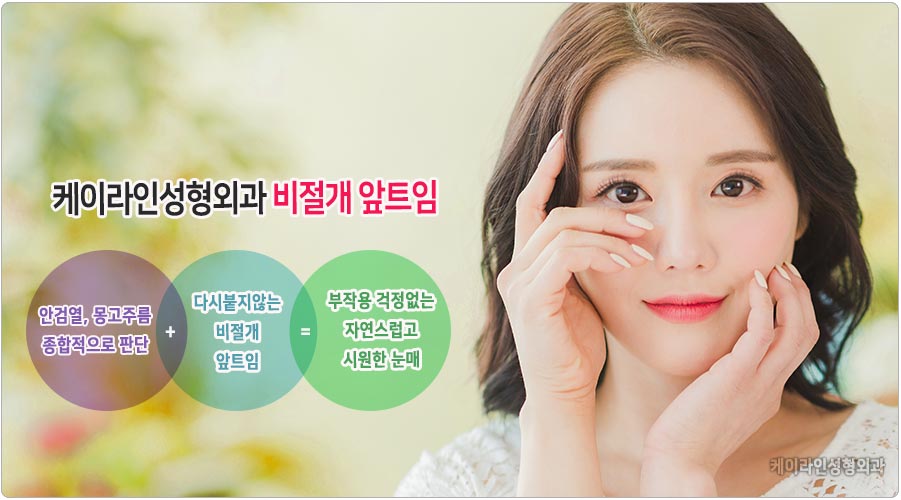 비절개 앞트임 장점