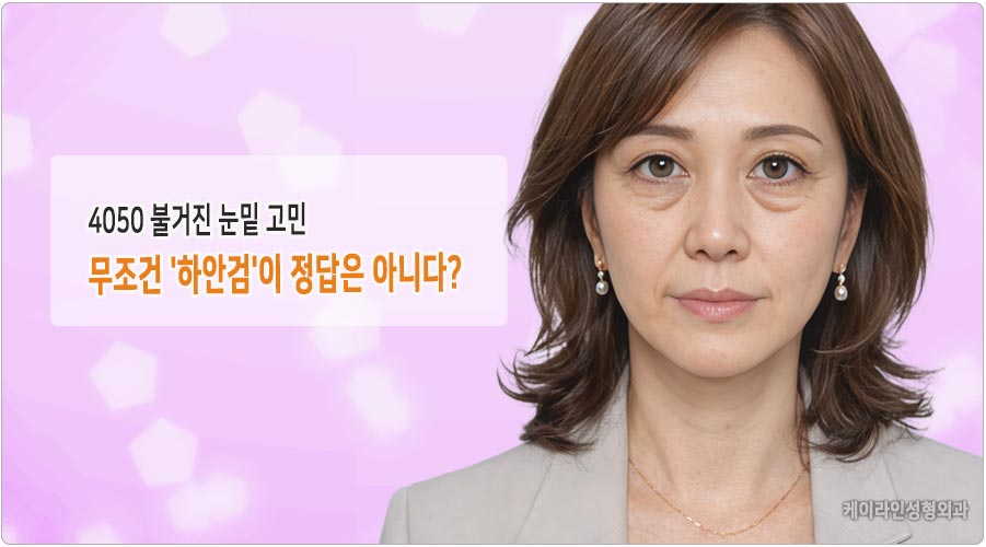 눈밑 지방 하안검