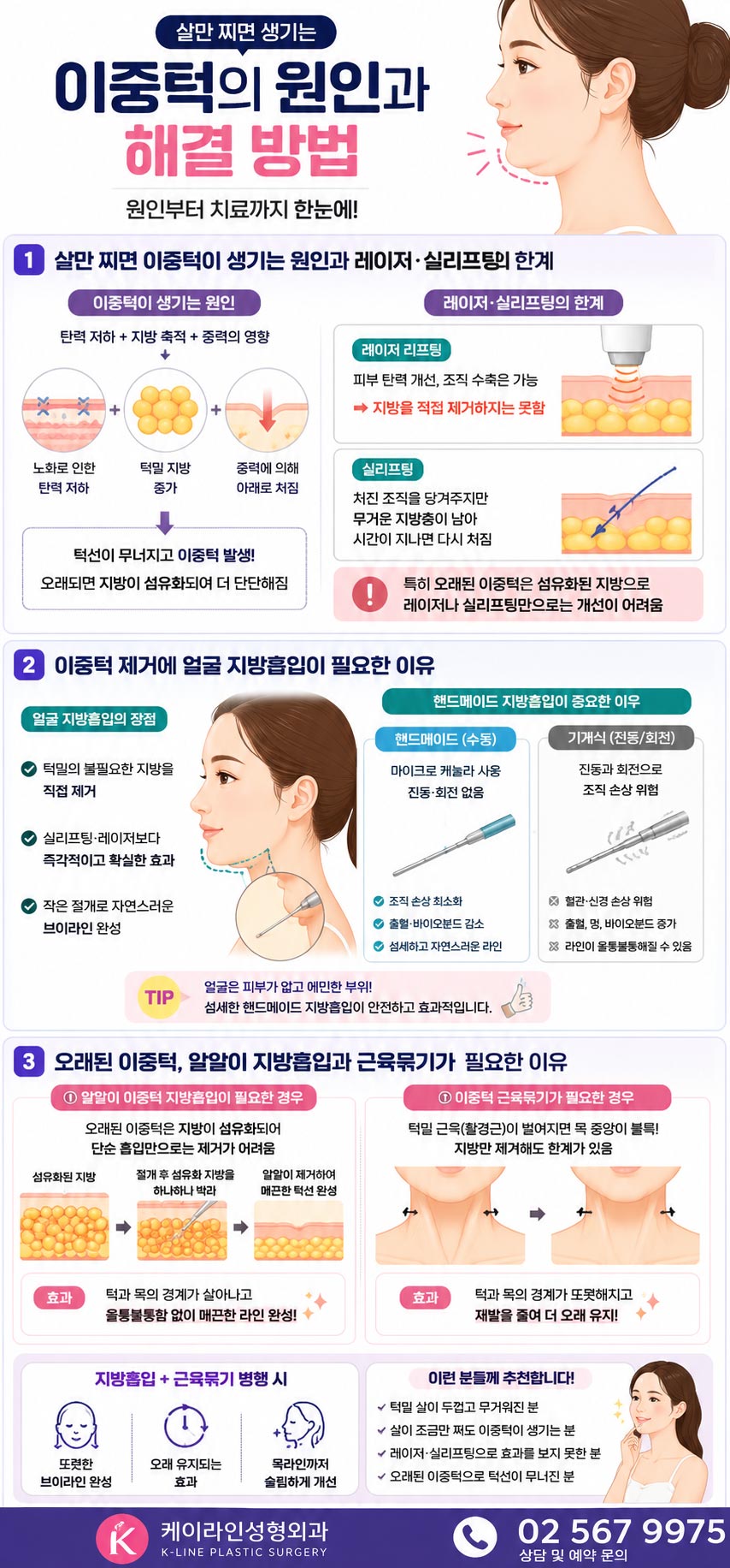 이중턱 제거 방법