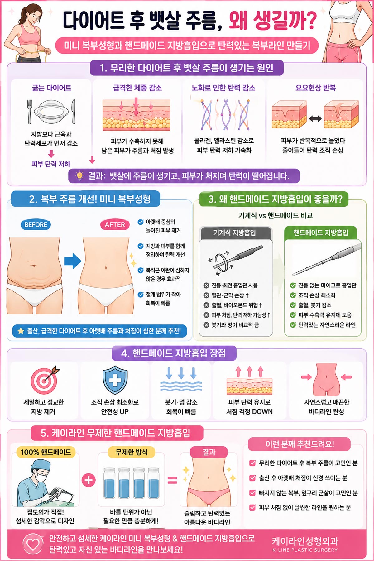 미니복부성형과 지방흡입 방법