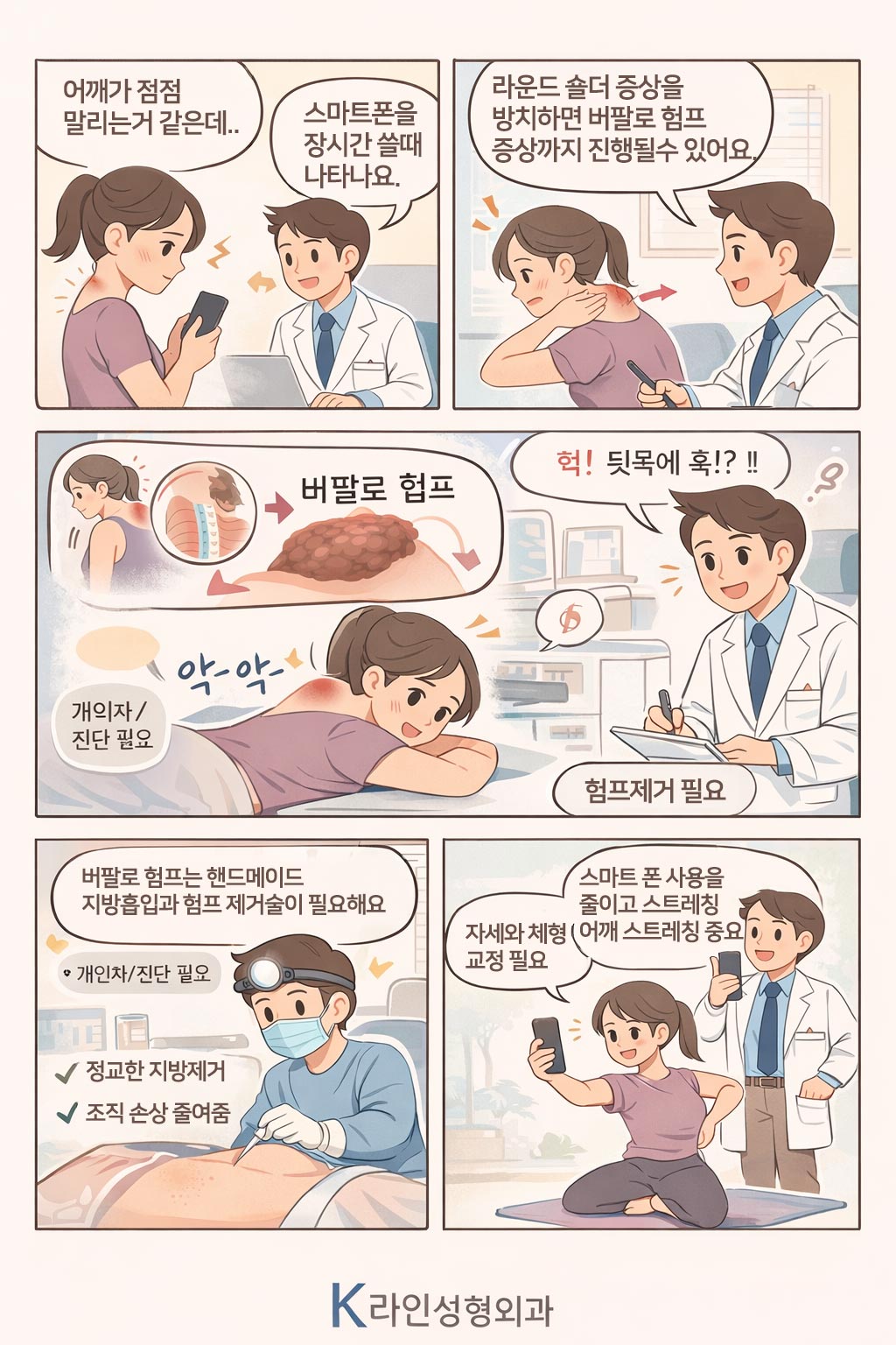 라운드숄더와 험프 제거