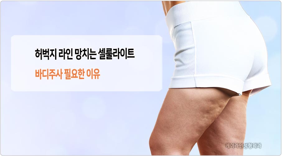 허벅지 셀룰라이트 바디주사 필요성