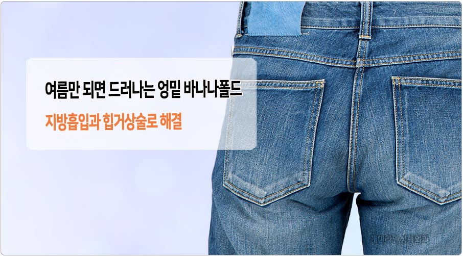 엉밑 바나나폴드 제거는 엉밑 지방흡입과 힙거상술