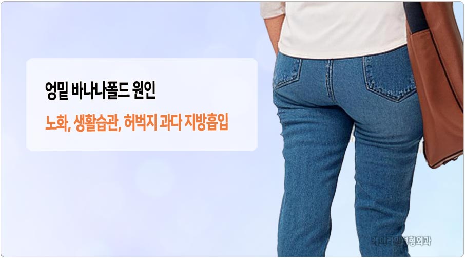 엉밑 바나나폴드 원인