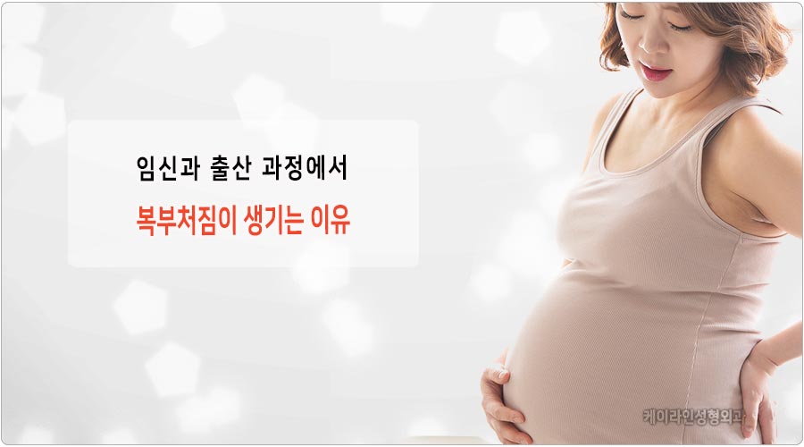 출산히 복부처짐 원인