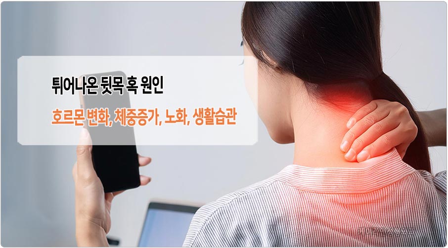 뒷목 혹 원인