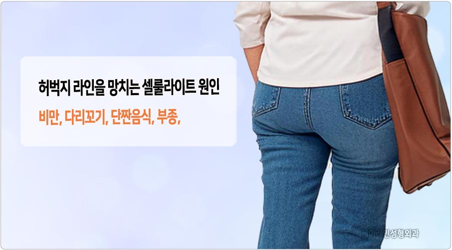 허벅지 셀룰라이트 원인