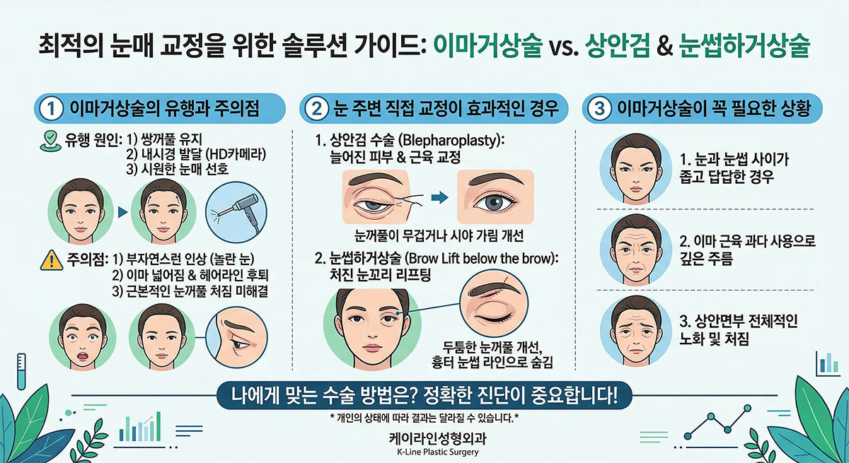 눈매교정 솔루션