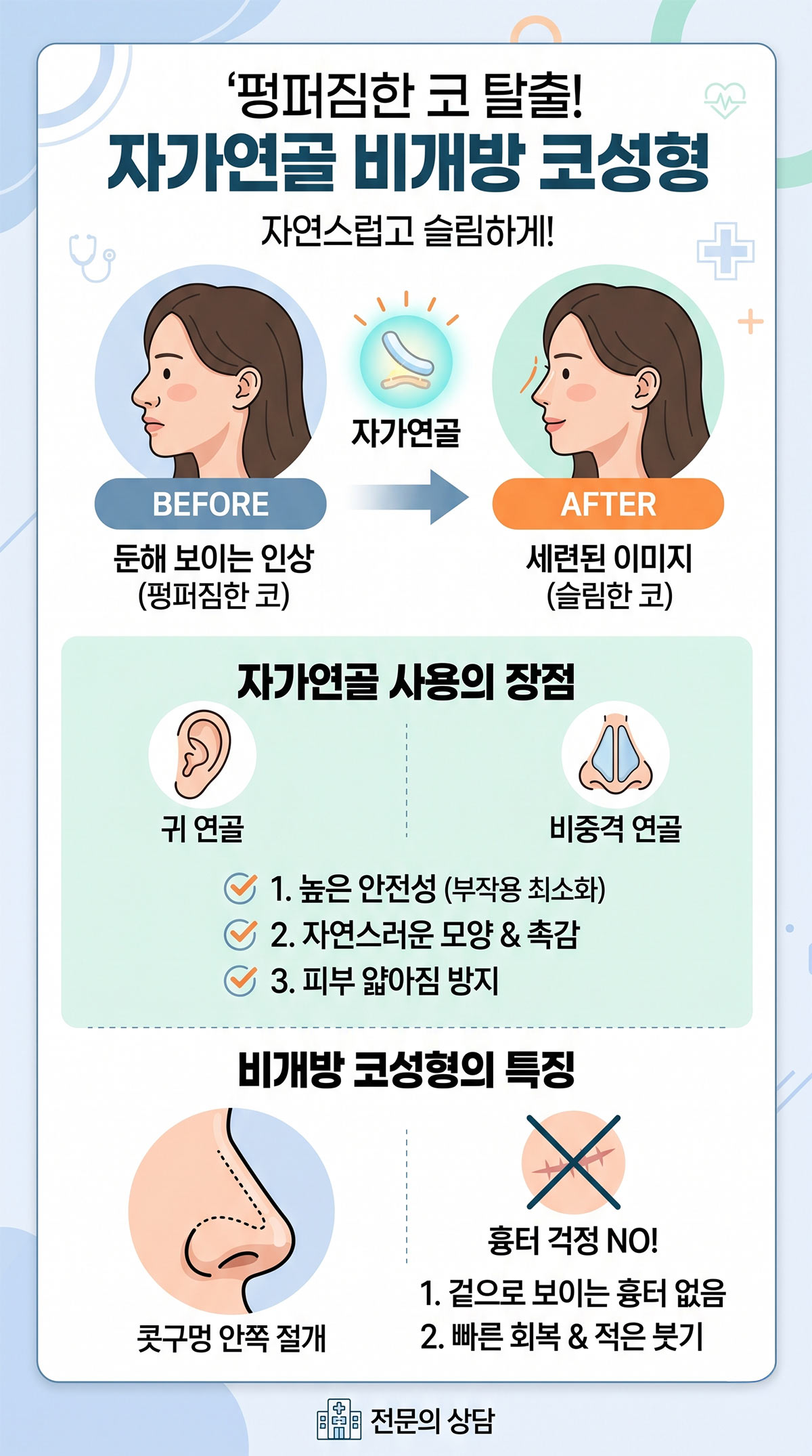 코 수술시 비개방 중요성