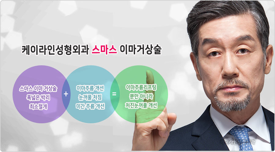 스마스 이마거상술
