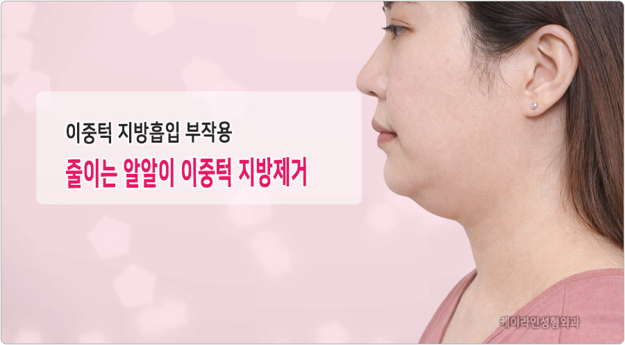 이중턱 지방흡입 부작용 줄이는 방법