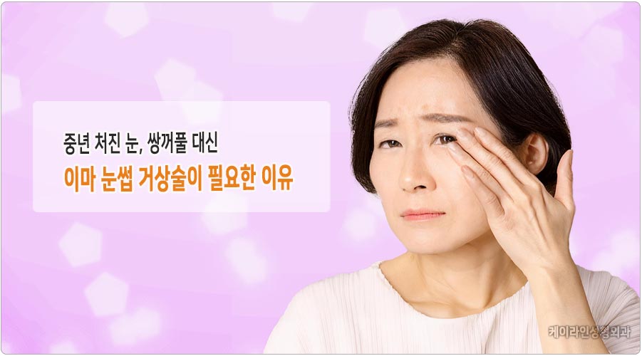 중년 처진 눈 눈썹거상술