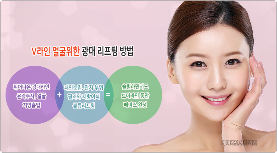 브이라인 리프팅